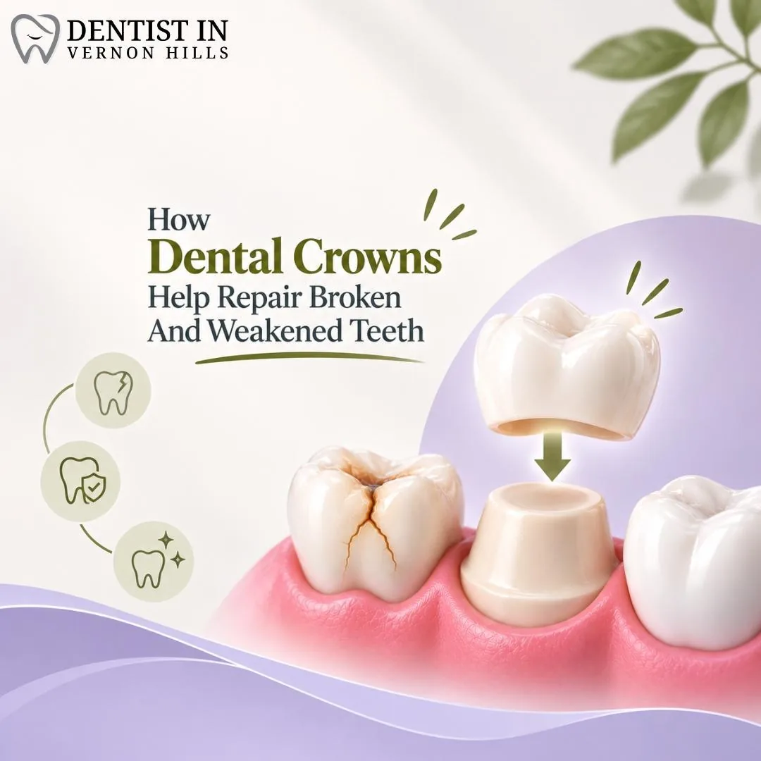 How Dental Crowns Help Repair Broken And Weakened Teeth