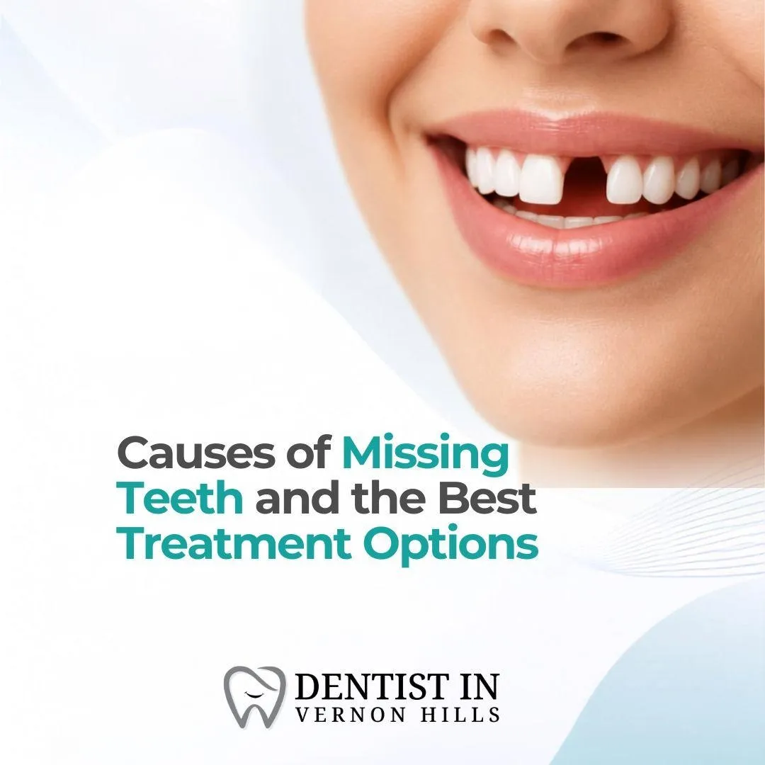 Causes of Missing Teeth and the Best Treatment Options
