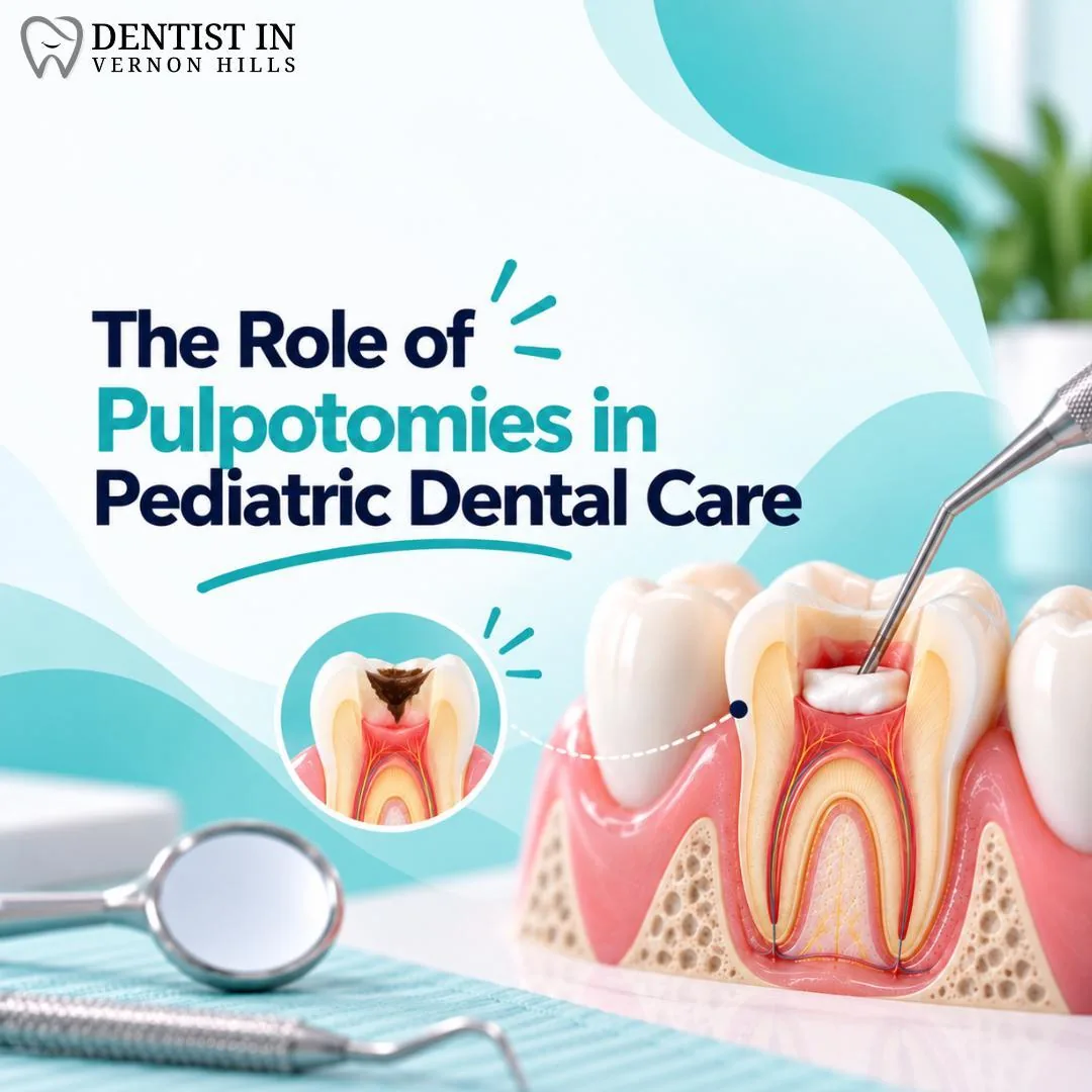 The Role of Pulpotomies in Pediatric Dental Care