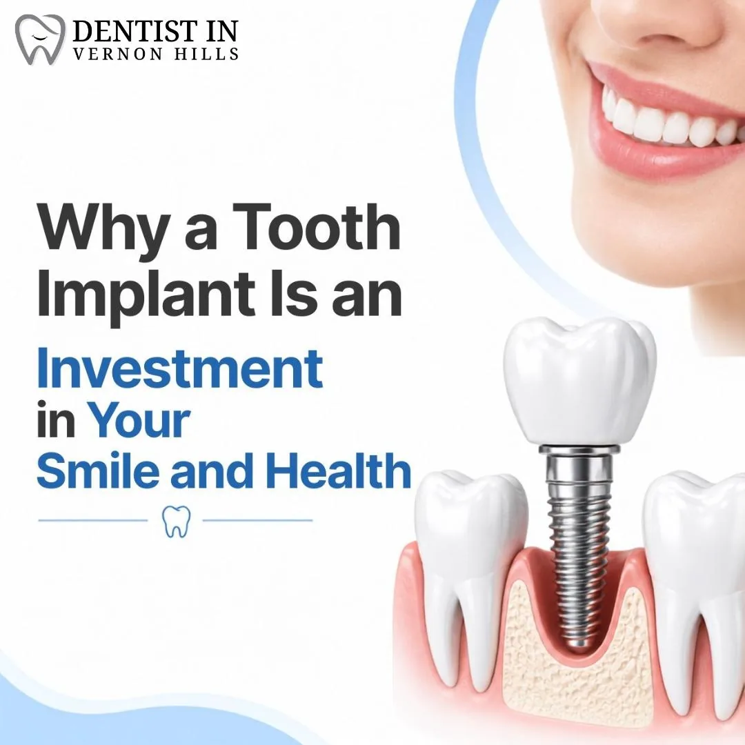 Why a Tooth Implant Is an Investment in Your Smile and Health