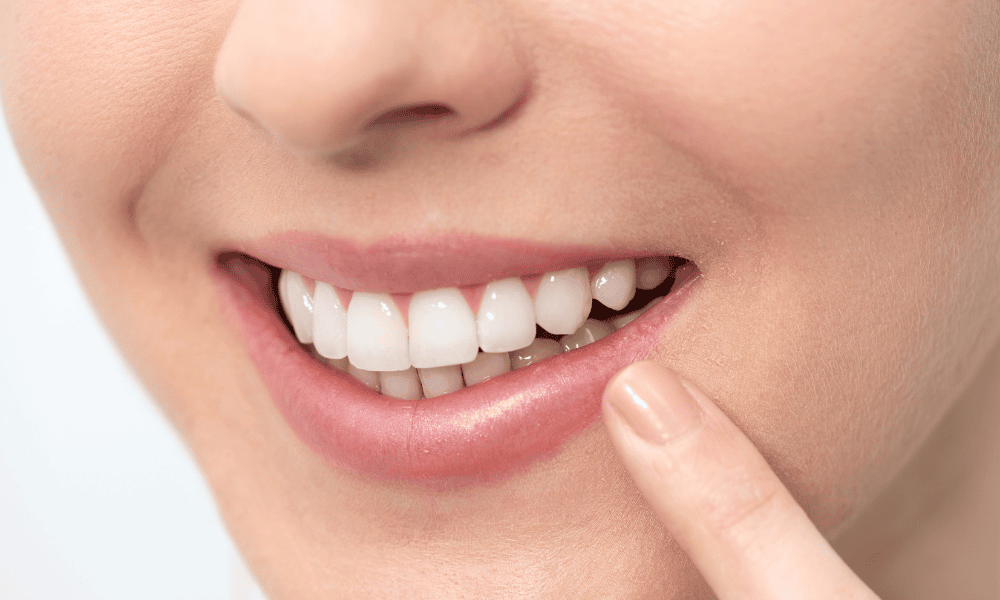 Why Choose Us for Teeth Whitening